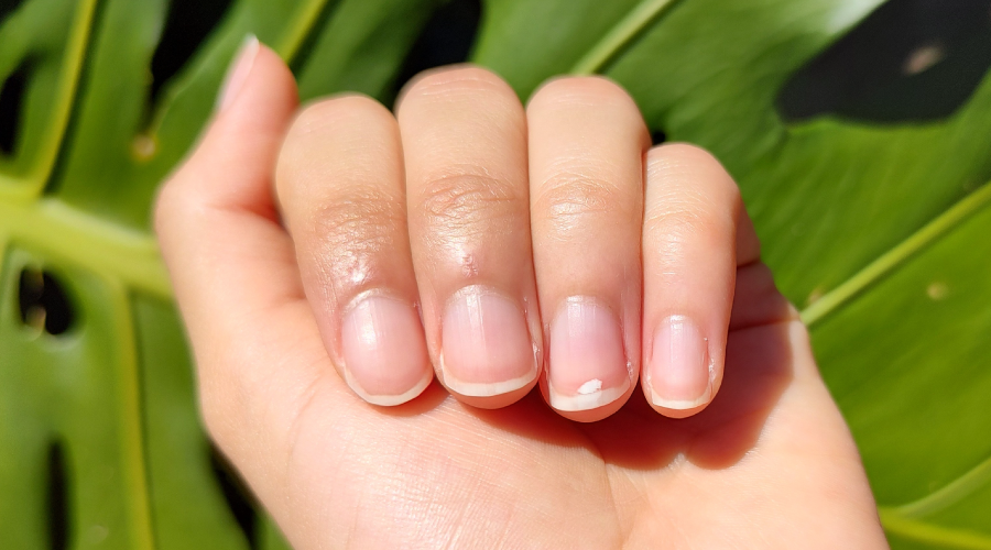 Healthy Nails